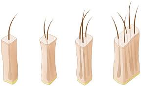 Follicular Units 