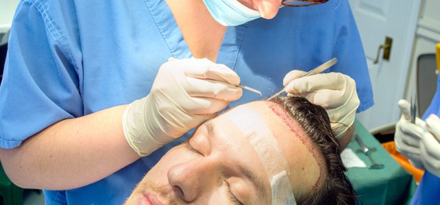 Hair Transplant Operation